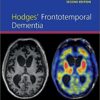 Hodges' Frontotemporal Dementia, 2nd Edition