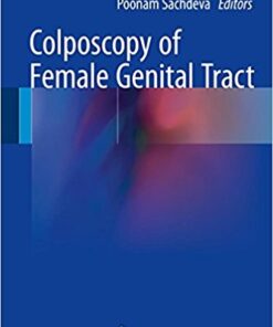 Colposcopy of Female Genital Tract 2017