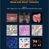 WHO Classification of Head and Neck Tumours (IARC WHO Classification of Tumours) 4th Edition
