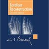 Forefoot Reconstruction 2nd Edition