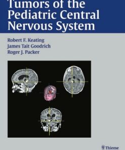 Tumors of the Pediatric Central Nervous System