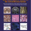 WHO Classification of Tumours of the Central Nervous System (IARC WHO Classification of Tumours) 4  Edition PDF ORIGINAL