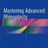 Mastering Advanced Rhinoplasty 1st ed. 2017 Edition PDF