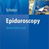 Epiduroscopy: Spinal Endoscopy 1st Edition PDF