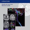 Diffusion Weighted and Diffusion Tensor Imaging: A Clinical Guide 1st Edition PDF