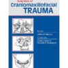 Essentials of Craniomaxillofacial Trauma PDF