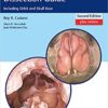 Endoscopic Sinonasal Dissection Guide: Including Orbit and Skull Base 2nd Edition PDF