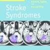 Stroke Syndromes, 3rd Edition PDF