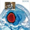 The NeuroICU Book, Second Edition (Neurology) 2nd Edition PDF