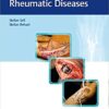 Surgery for Rheumatic Diseases 1st Edition PDF