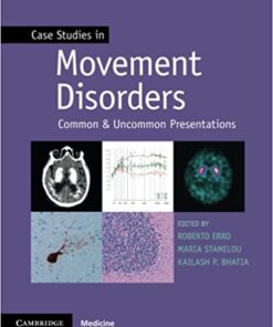 Case Studies in Movement Disorders: Common and Uncommon Presentations 1st Edition PDF