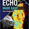 Echo Made Easy, 3rd Edition PDF