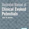 Illustrated Manual of Clinical Evoked Potentials PDF