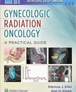Gynecologic Radiation Oncology: A Practical Guide 1  Edition PDF