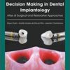 Decision Making in Dental Implantology PDF