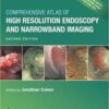 Comprehensive Atlas of High Resolution Endoscopy and Narrowband Imaging 2nd Edition (PDF)