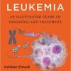 Acute Leukemia An Illustrated Guide to Diagnosis and Treatment (PDF)