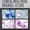 Core Concepts in Clinical Infectious Diseases (CCCID) 1st Edition PDF