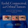 Eyelid, Conjunctival, and Orbital Tumors An Atlas and Textbook Third Edition PDF