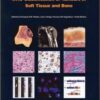 WHO Classification of Tumours of Soft Tissue and Bone (IARC WHO Classification of Tumours) 4th Edition PDF