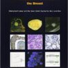 WHO Classification of Tumours of the Breast (IARC WHO Classification of Tumours) 4th Edition PDF