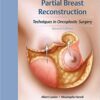 Partial Breast Reconstruction Techniques in Oncoplastic Surgery 2nd Edition PDF