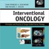 Interventional Oncology: Principles and Practice of Image-Guided Cancer Therapy 2nd Edition PDF