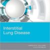 Interstitial Lung Disease PDF