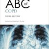 ABC of COPD 3rd Edition PDF