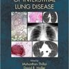 Clinical Handbook of Interstitial Lung Disease 1st Edition PDF