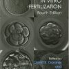 Handbook of In Vitro Fertilization, Fourth Edition 4th Edition PDF