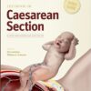 Textbook of Caesarean Section 1st Edition PDF