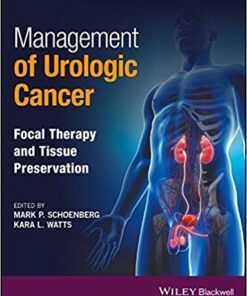 Management of Urologic Cancer: Focal Therapy and Tissue Preservation 1st Edition PDF