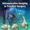 Illustrated Tips and Tricks for Intraoperative Imaging in Fracture Surgery EPUB