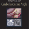 Surgery of the Cerebellopontine Angle 1st Edition PDF
