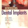 Introducing Dental Implants, 1e 1st Edition PDF