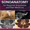 Atlas of Sonoanatomy for Regional Anesthesia and Pain Medicine EPUB
