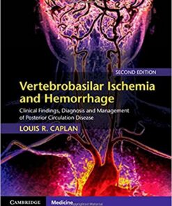 Vertebrobasilar Ischemia and Hemorrhage: Clinical Findings, Diagnosis and Management of Posterior Circulation Disease 2nd Edition PDF