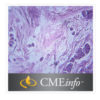 Breast Pathology – Masters of Pathology Series – Videos + PDF