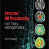 Advanced MR Neuroimaging: From Theory to Clinical Practice (Series in Medical Physics and Biomedical Engineering) 1st Edition PDF