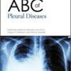 ABC of Pleural Diseases PDF