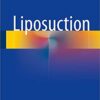 Liposuction 1st ed. 2018 Edition PDF