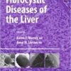 Fibrocystic Diseases of the Liver (Clinical Gastroenterology) 2010th Edition PDF