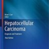 Hepatocellular Carcinoma: Diagnosis and Treatment (Current Clinical Oncology) 3rd ed. 2016 Edition PDF