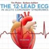 The 12-Lead ECG in Acute Coronary Syndromes 4th Edition PDF