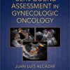 Ultrasound Assessment in Gynecologic Oncology 1st Edition PDF