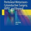 Management of Peritoneal Metastases- Cytoreductive Surgery, HIPEC and Beyond 1st ed. 2018 Edition PDF