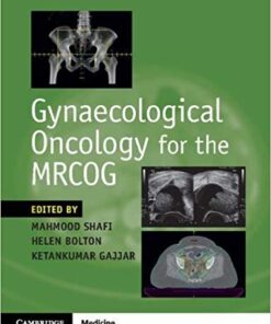 Gynaecological Oncology for the MRCOG 1st Edition PDF