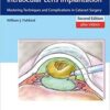 Phacoemulsification and Intraocular Lens Implantation: Mastering Techniques and Complications in Cataract Surgery 2nd Edition PDF