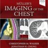 Muller’s Imaging of the Chest: Expert Radiology Series 2nd Edition PDF